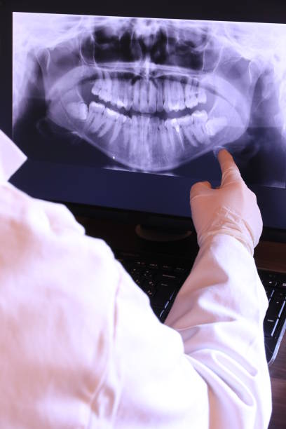Best Emergency Wisdom Teeth Removal in Spring Hill, KS