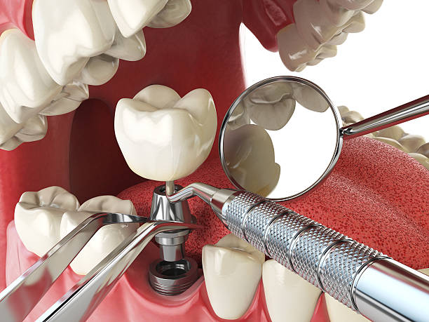 Best After-Hours Dental Trauma Care in Spring Hill, KS